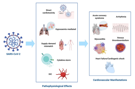 Posibles mecanismos de la injuria cardiovascular debido al COVID-19.